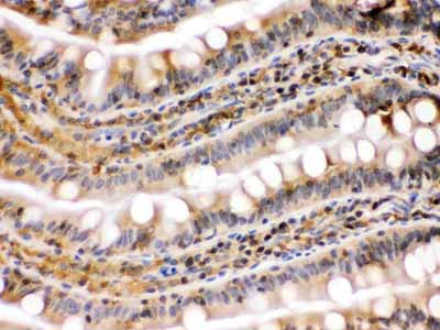 2 - Anti-Hsp90 Beta Picoband Antibody ABO12322