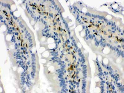2 - Anti-Hsp70 Picoband Antibody ABO12324