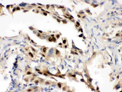 2 - Anti-Hsp70 Picoband Antibody ABO12324