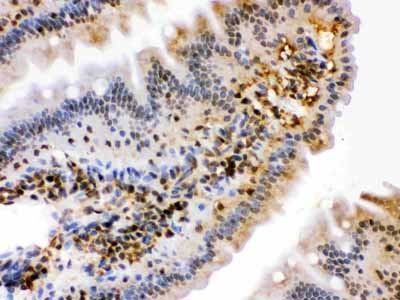 2 - Anti-HSPA2 Picoband Antibody ABO12325