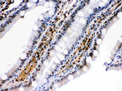 2 - Anti-HSPA2 Picoband Antibody ABO12325