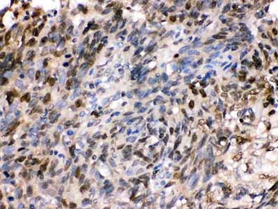 2 - Anti-HSPA2 Picoband Antibody ABO12325