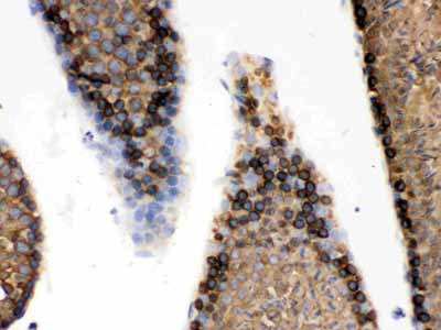2 - Anti-GRP78 BiP Picoband Antibody ABO12326