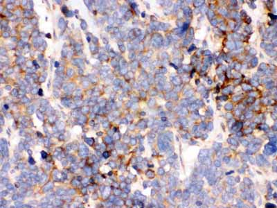 2 - Anti-GRP78 BiP Picoband Antibody ABO12326