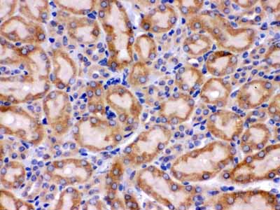 2 - Anti-Grp75 Picoband Antibody ABO12328