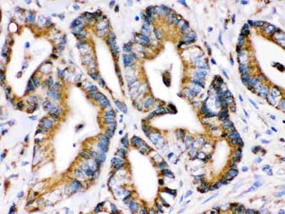 2 - Anti-Grp75 Picoband Antibody ABO12328