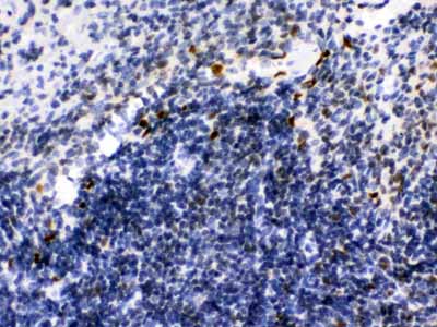 2 - Anti-Ikaros Picoband Antibody ABO12329