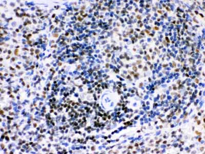 2 - Anti-Ikaros Picoband Antibody ABO12329