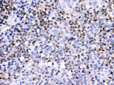 2 - Anti-Ikaros Picoband Antibody ABO12329