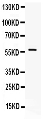 1 - Anti-Ikaros Picoband Antibody ABO12329