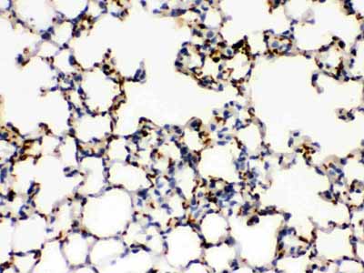 2 - Anti-ITGA2B Picoband Antibody ABO12333