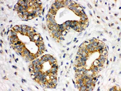 2 - Anti-ITGA2B Picoband Antibody ABO12333