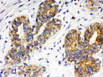 2 - Anti-Integrin Alpha 4 Picoband Antibody ABO12334