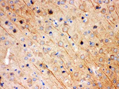 2 - Anti-KChIP2 Picoband Antibody ABO12338