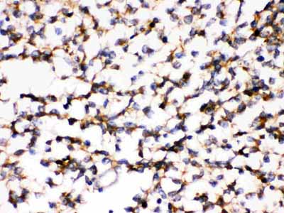 2 - Anti-KChIP2 Picoband Antibody ABO12338