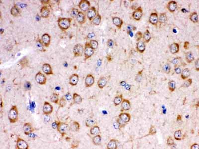 2 - Anti-KChIP2 Picoband Antibody ABO12338