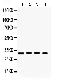 1 - Anti-KChIP2 Picoband Antibody ABO12338