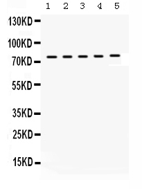 1 - Anti-KIF3A Picoband Antibody ABO12340