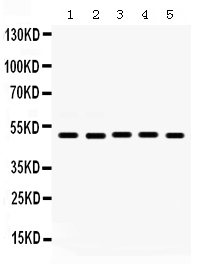 1 - Anti-Galectin 8 Picoband Antibody ABO12345