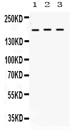 1 - Anti-LIFR Picoband Antibody ABO12347