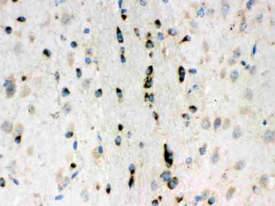 2 - Anti-Lumican Picoband Antibody ABO12348