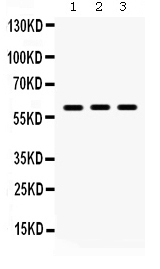 1 - Anti-Lumican Picoband Antibody ABO12348
