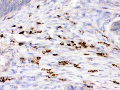 2 - Anti-Lysozyme Picoband Antibody ABO12349