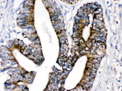 2 - Anti-MAOA Picoband Antibody ABO12350
