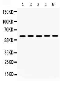 1 - Anti-MAOA Picoband Antibody ABO12350
