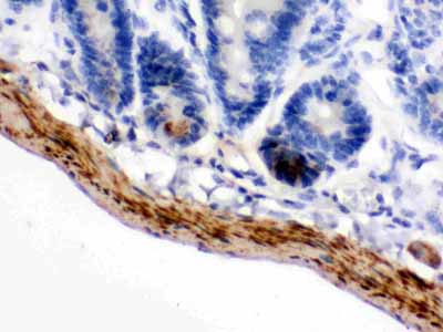 2 - Anti-MAOB Picoband Antibody ABO12351