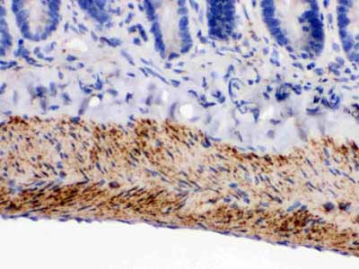 2 - Anti-MAOB Picoband Antibody ABO12351
