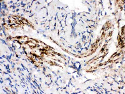 2 - Anti-MAOB Picoband Antibody ABO12351