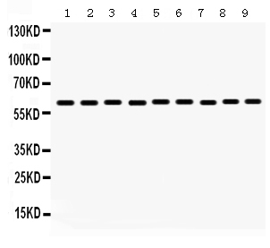 1 - Anti-MAOB Picoband Antibody ABO12351