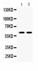1 - Anti-MAOB Picoband Antibody ABO12351