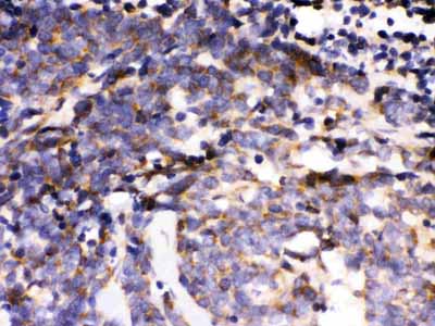 2 - Anti-MAPK6 Picoband Antibody ABO12352