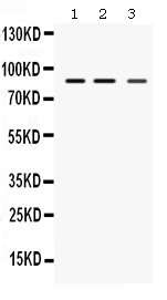 1 - Anti-MEFV Picoband Antibody ABO12353