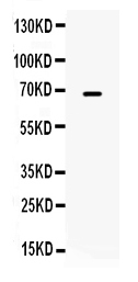1 - Anti-MMP-9 Antibody ABO12354