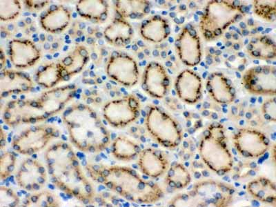 2 - Anti-MMP-9 Antibody ABO12355