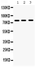 1 - Anti-MMP-9 Antibody ABO12355