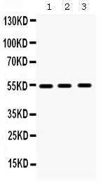 1 - Anti-MMP10 Picoband Antibody ABO12356