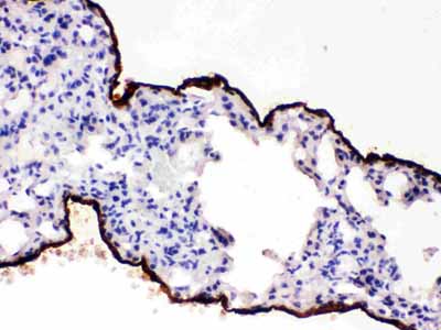 2 - Anti-Mesothelin Picoband Antibody ABO12357