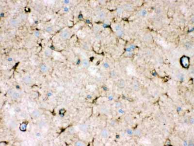 2 - Anti-NDRG2 Picoband Antibody ABO12358
