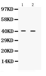 1 - Anti-NDRG2 Picoband Antibody ABO12358