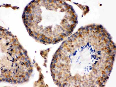2 - Anti-S100 Alpha 6 Picoband Antibody ABO12362