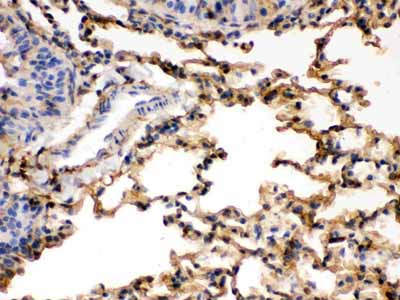 2 - Anti-S100 Alpha 6 Picoband Antibody ABO12362