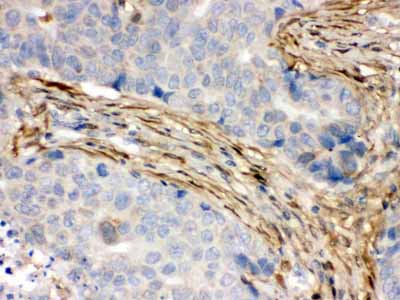 2 - Anti-S100 Alpha 6 Picoband Antibody ABO12362