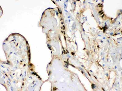 2 - Anti-S100 Alpha 6 Picoband Antibody ABO12362