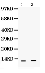 1 - Anti-S100 Alpha 6 Picoband Antibody ABO12362