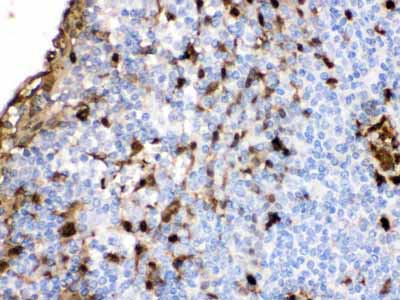 2 - Anti-S100A9 Picoband Antibody ABO12363