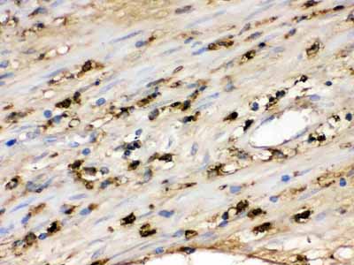 2 - Anti-S100A9 Picoband Antibody ABO12363